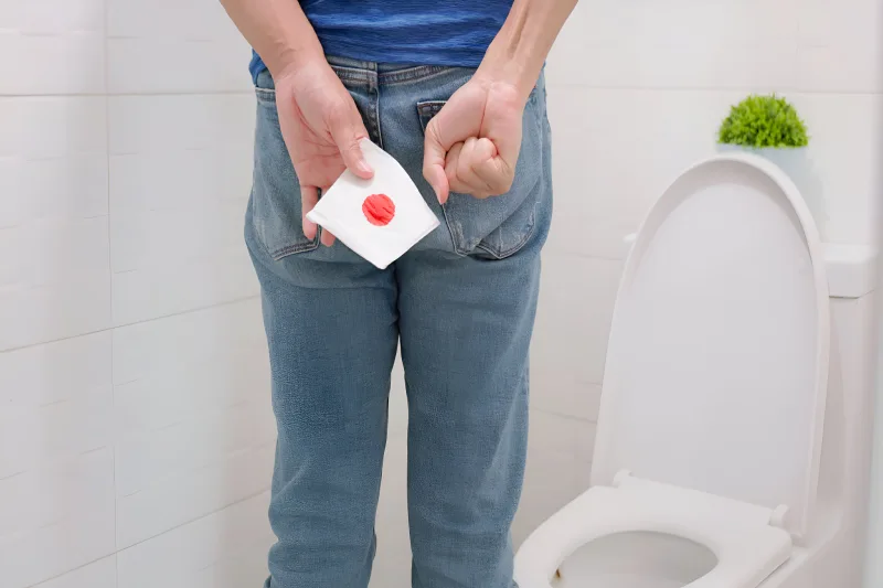 เลือดออกทางทวารหนัก เกิดจากริดสีดวงหรือโรคอื่น