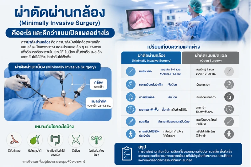 ผ่าตัดผ่านกล้อง (Minimally Invasive Surgery) คืออะไร และดีกว่าแบบเปิดแผลอย่างไร